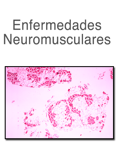 neuromuscularv2.png