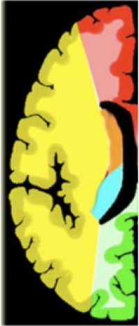 SMALL ictus12